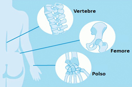 È la malattia "silenziosa":  i servizi contro l'osteoporosi