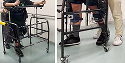 Ictus, tornare a camminare: progressi importanti dalla ricerca